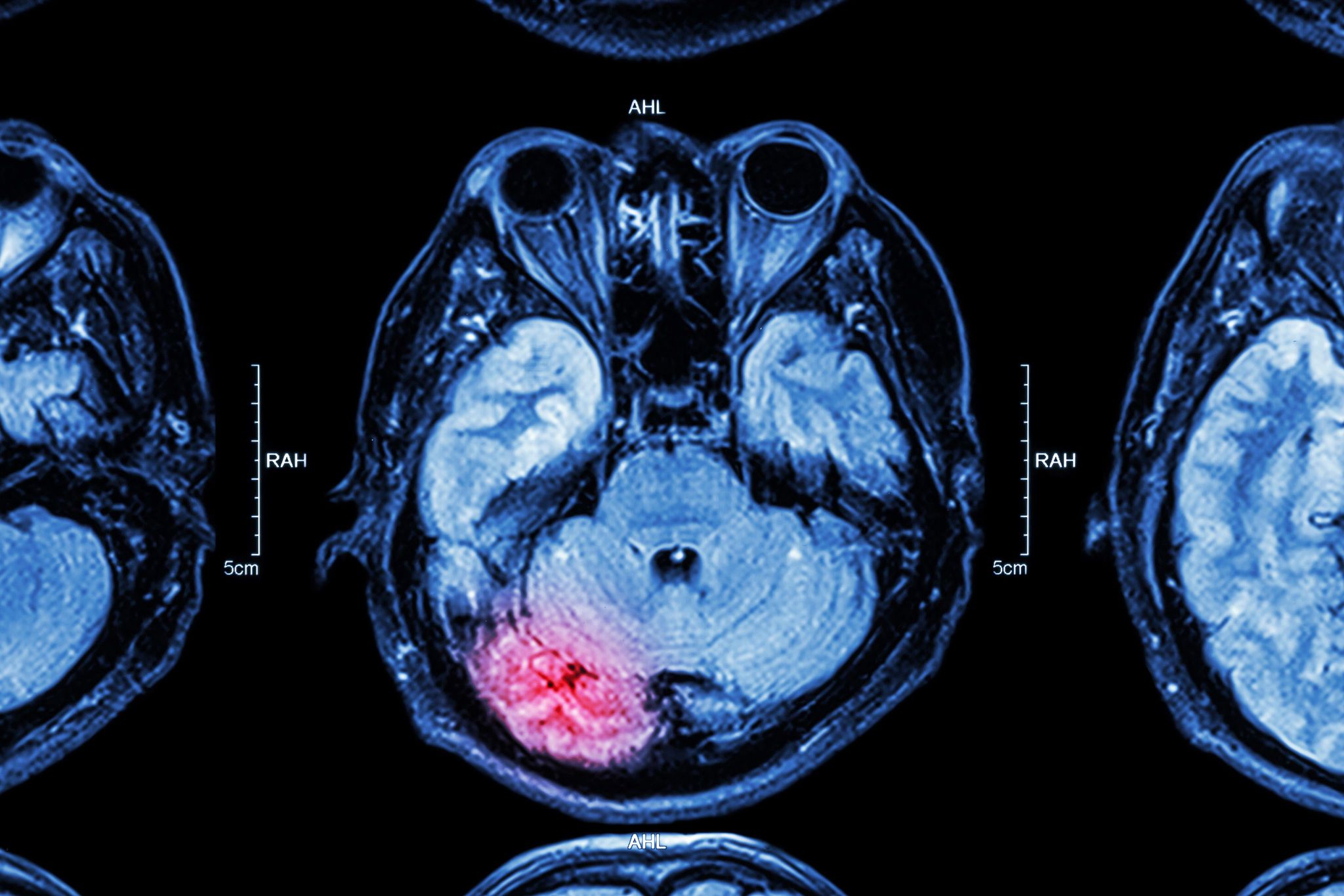brain scan